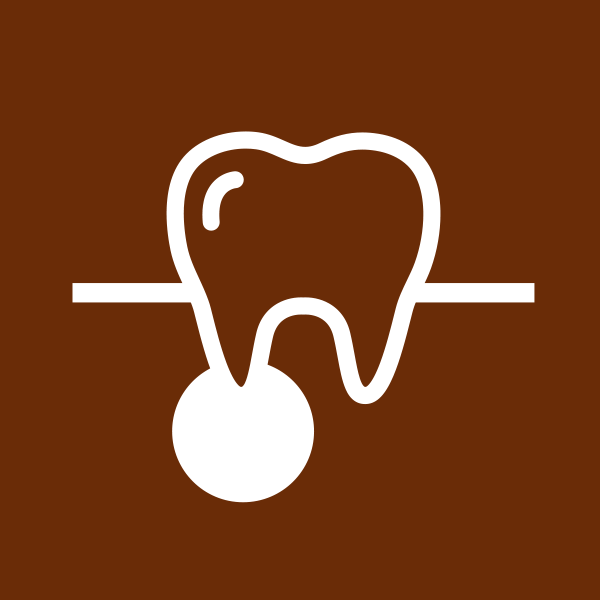 歯根のう胞摘出処置